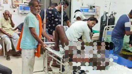सादाबाद: कोकना खुर्द के जले हुए युवक को गंभीर हालत में चिकित्सकों ने अलीगढ़ मेडिकल कॉलेज किया रेफर