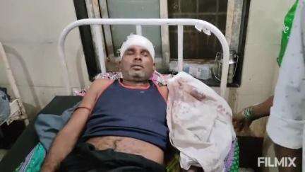 मुरैना नगर: घाडोर गांव में दरवाजे से मोटरसाइकिल हटाने को लेकर विवाद, पिता और पुत्री घायल, अस्पताल में भर्ती