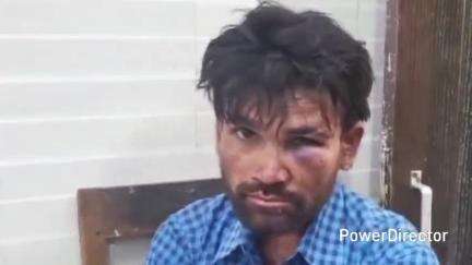 सिवनी: चक्की खमरिया गांव में मामूली विवाद के बाद युवक के साथ मारपीट, पुलिस कर रही जांच