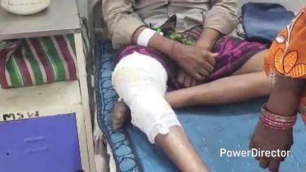 कुरई: जनावर खेड़ा गांव में गर्म पानी की चपेट में आने से एक व्यक्ति घायल