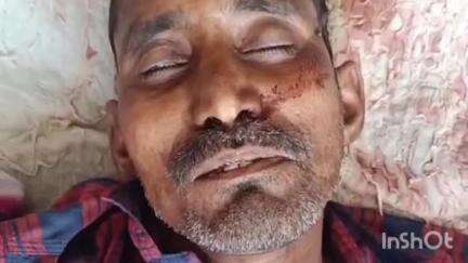 मेदिनीनगर (डालटनगंज): राजपुर गांव में मामूली विवाद के बाद एक व्यक्ति की पीट-पीटकर हत्या, आरोपी फरार