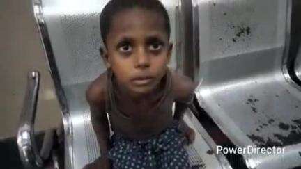 कटिहार: कटिहार के हथियादियारा में घर में खेलते समय नाबालिग को जहरीले सांप ने डंसा, इलाज के लिए भर्ती, परिजन चिंतित