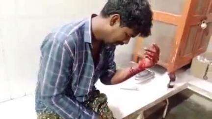 గుంతకల్లు: గుత్తి ఆర్ఎస్ రోడ్డు లోని సాయి డిగ్రీ కాలేజ్ సమీపంలో బైక్ అదుపు తప్పి బోల్తా వ్యక్తికి తీవ్ర గాయాలు