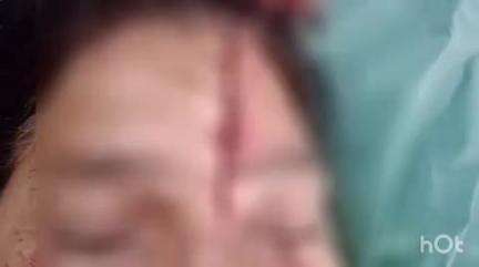बिजनौर: बिजनौर के मोहल्ला जाटान में दो पक्षों के बीच खूनी संघर्ष, एक महिला की हालत नाजुक