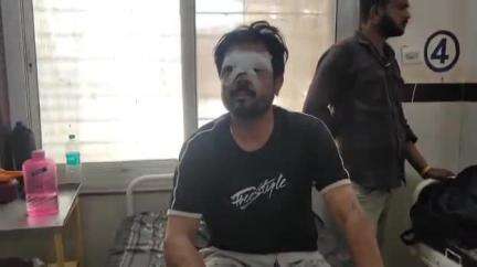 शिवपुरी नगर: झांसी तिराहा के पास कचरा फेंकने को लेकर विवाद, युवक को दुकान में बंद कर 4 लोगों ने की मारपीट, आंखों में मिर्ची डाली