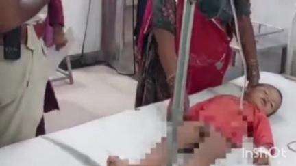 रोहट: रोहट के इंद्रो की ढाणी निवासी 3 साल के मासूम को बाइक सवार ने चपेट में लिया, गंभीर रूप से घायल