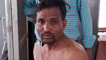बिल्सी: सीतापुर गांव में गाली-गलौज का विरोध करने पर एक परिवार को पड़ा भारी, दबंगों ने लाठी-डंडों से की मारपीट