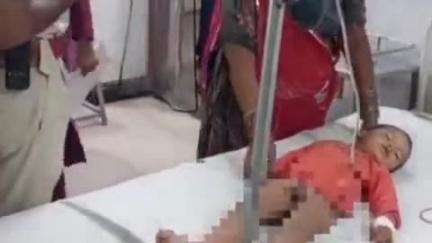पाली में मासूम को बाइक सवार ने चपेट में लिया घर के बाहर खेल रहा था हादसे में सिर में आई गंभीर चोट इलाज जारी