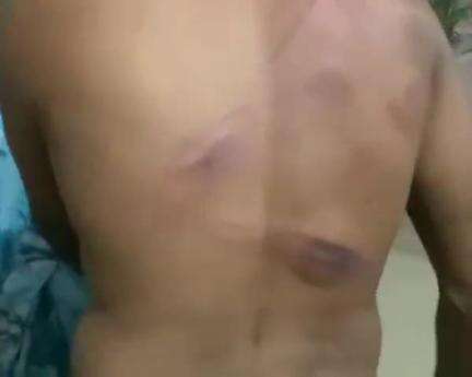 डिंडौरी: शहपुरा में युवक की बेरहमी से पिटाई, पीड़ित ने पुलिस अधीक्षक से लगाई गुहार, सोशल मीडिया पर वीडियो हुआ वायरल