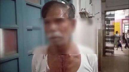 सतना के मल्हान टोला में नाती ने दादा पर हमला किया, दादा ने थाने में शिकायत दर्ज कराई, पुलिस जांच कर रही है