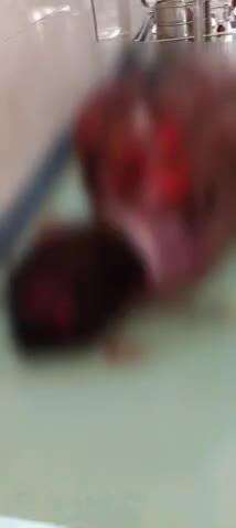 কেশপুর: কেশপুরের ঝলকা এলাকায় বাইক দুর্ঘটনায় গুরুতর আহত হলেন এক ব্যক্তি, রেফার করা হলো মেদিনীপুর হাসপাতালে