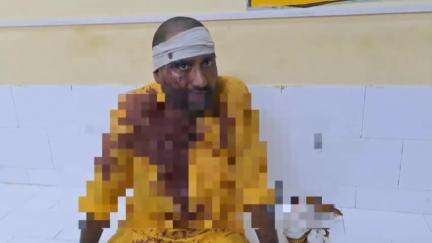 शाहबाद: मैकपुर चौराहे पर 10 रुपये के लिए दुकानदार ने ग्राहक पर ईंट से हमला कर लहूलुहान किया, नामजद रिपोर्ट दर्ज