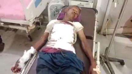 गुमला: कुलमुंडा जंगल में बम विस्फोट, एक व्यक्ति गंभीर रूप से घायल, रिम्स रेफर