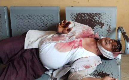 गोगरी: मुश्किपुर में अतिक्रमित जमीन पर दीवार नहीं हटाने को लेकर मारपीट, एक घायल