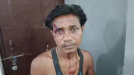 जशपुर: जशपुर में मामूली विवाद के चलते चाचा-भतीजे के बीच झगड़ा, चाचा घायल अवस्था में पहुंचे कोतवाली थाना