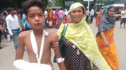 বহরমপুর: আম গাছ থেকে পড়ে হাত ভেঙে আহত vii এর এক ছাত্র, চিকিৎসাধীন বহরমপুর MMC হাসপাতালে