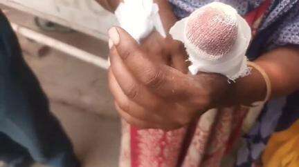 বহরমপুর: মির্জাপুরে গরুর খড় কাটতে গিয়ে আঙুল কেটে জখম এক গৃহবধূ, চিকিৎসার জন্য আনা হয় বহরমপুর MMC হাসপাতালে