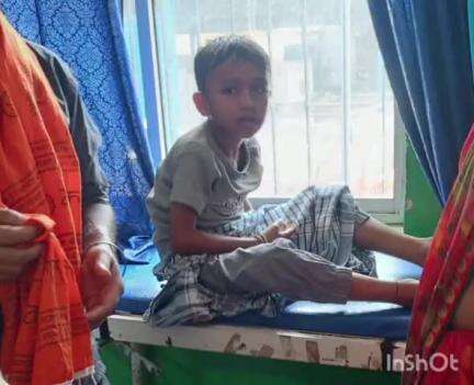 कोडरमा: चुटियारो में आवारा कुत्ते के हमले में दो बच्चे घायल, सदर अस्पताल में भर्ती