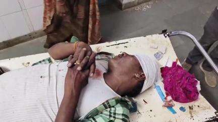 डूंगरपुर: डू हथार्ई गांव के पास सड़क पर अचानक गाय के बछड़े के आने से बाइक सवार दंपती की टक्कर, हादसे में दोनों गंभीर रूप से घायल