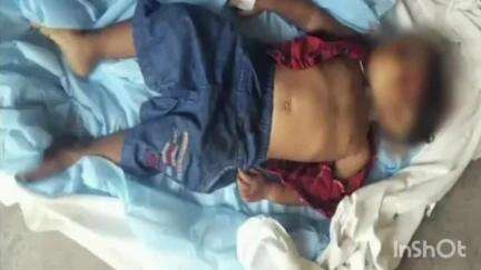 कोरबा: शारदा विहार क्षेत्र में बारात में हुए हादसे में दूल्हे के गोद में बैठे डेढ़ वर्षीय मासूम की हुई मृत्यु, एक घायल