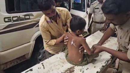 कांकेर: कलमीपारा में शादी कार्यक्रम से वापस आ रहे 3 वर्ष के मासूम पर तेंदुए ने किया हमला