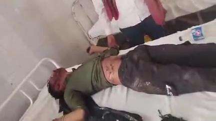 रसूलाबाद: सिसाही रामपुर रोड पर दो बाइकों की भिड़ंत में तीन लोग घायल, सीएचसी में उपचार के बाद दो को हैलट रेफर किया गया
