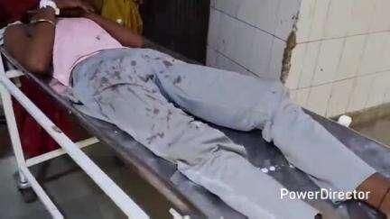 मऊ: झांसी मिर्जापुर मुख्य सड़क में रामनगर के पास साइकिल सवार को बचाने के प्रयास में बाइक सवार गिरकर घायल, जिला अस्पताल रेफर