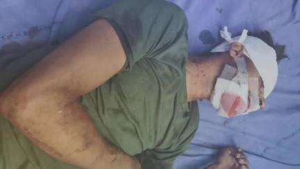 গাজোল: ময়না 12 নং জাতীয় সড়ক এলাকায় পন্যবাহী লরি ওভারটেক করতে গিয়ে ধাক্কা লেগে গাড়ি চালক সহ একাধিক প্যাসেঞ্জার আহত হয়