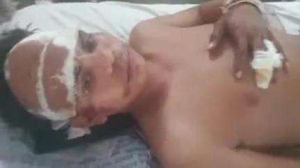 मांगरौल: मांगरोल रामगढ़ रोड पर बाइक अनियंत्रित होकर फिसलने से एक युवक गंभीर घायल, जिला अस्पताल में कराया भर्ती