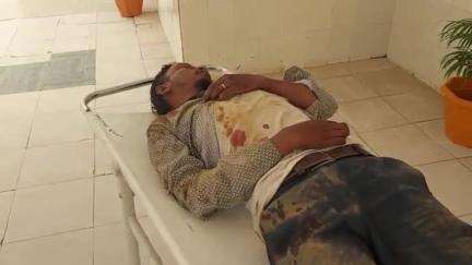 कुरडेग: चापाबारी के पास मोटरसाइकिल से गिरने से नशे में धुत युवक हुआ घायल, सदर अस्पताल में भर्ती