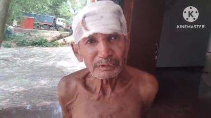 पथरगामा: पथरगामा बिषाहा डुमरी टोला गांव में पतोहू ने ससुर पर डंडे से हमला कर सिर फोड़ा