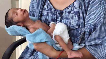 बालाघाट: जन्मजात हृदय रोग से पीड़ित मासूम अब स्वस्थ, जिला अस्पताल बालाघाट के सिविल सर्जन ने दी जानकारी