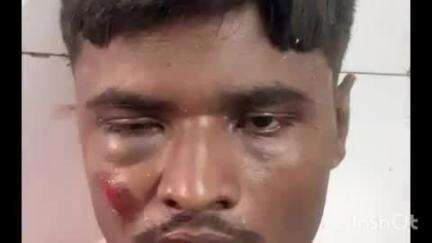कायमगंज: कायमगंज क्षेत्र में दो अलग-अलग सड़क हादसों में 6 लोग हुए घायल, सभी घायलों को सीएचसी में कराया गया भर्ती