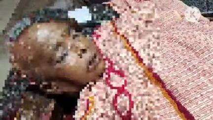 రోడ్డు ప్రమాదంలో గాయపడిన మహిళ  నగరంలోని సూపర్ స్పెషాలిటీ ఆసుపత్రిలో చికిత్స పొందుతూ మృతి