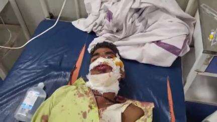 जहानाबाद: सड़क दुर्घटना में गंभीर रूप से घायल व्यक्ति सदर अस्पताल में भर्ती