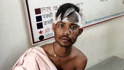 मऊगंज: पन्नी गांव में बारातियों के बीच जमकर हुई मारपीट; ज़मीन पर सो रहे बारातियों पर चढ़ाया गया बोलेरो वाहन, 4 लोग हुए घायल