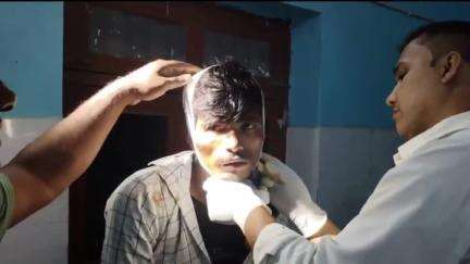 चकिया पिपरा: बखरी बाजार के पास सोमवार की संध्या एन-एच 28 पर घोड़परास के हमले में एक बाइक सवार युवक घायल