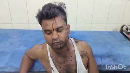 बरेली: बारादरी थाना क्षेत्र के संजय नगर में दबंगों ने युवक को बेरहमी से जमकर पीटा