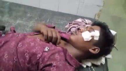 अशोक नगर: फुटेरा गांव: मामूली विवाद में दबंग ने 18 वर्षीय युवक पर पत्थर से किया हमला, युवक अस्पताल में भर्ती