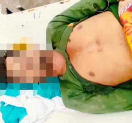पकरीबरावां: ज्यूरी में वज्रपात से युवक की मौत, गांव में शोक का माहौल