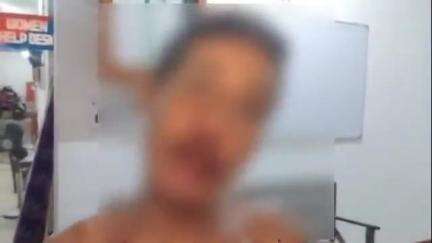 অমরপুর: অতর্কিতভাবে আক্রমণ উদয়পুর গোকুলপুর মধ্যপাড়া এলাকায় ছোট ভাই ও তার স্ত্রীর উপর বড় ভাই এবং ভাতিজা মিলে