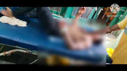 কুলপি: কুলপি করঞ্জলিতে স্বামী স্ত্রী বাইক দুর্ঘটনায় গুরুতর যখম, আহত অবস্থায়  হাসপাতালে ভর্তি করার হয়