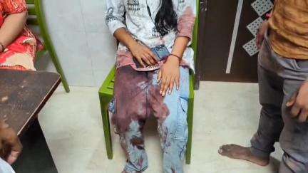 रहुई: निजाय गांव के पास गोखुलपुर थाने की पुलिस गाड़ी ने बाइक सवार को टक्कर मारी, तीन लोग हुए घायल