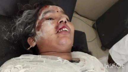 बंशीधरनगर (नगर उंटारी): सिंघी ताली सड़क पर बाइक फिसलने से बहियार कलां गांव की महिला और बच्ची घायल, अस्पताल में भर्ती