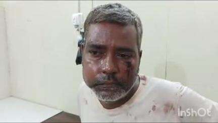 भोगनीपुर: भोगनीपुर में दुकानदार को पड़ोसी दुकानदार ने किया मारपीट, घायल ने कोतवाली में दिया शिकायती पत्र
