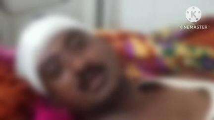मिरज: रामनगर मध्ये दोघांना दगडाने मारहान;सांगली शहर पोलीस ठाण्यात गुन्हा दाखल