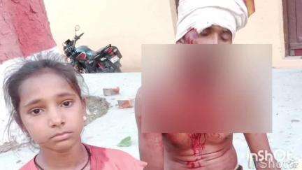 कलान: परौर में बच्चों के विवाद में लाठी चले, दोनों तरफ से चार लोग घायल, प्रभारी निरीक्षक को दी गई शिकायती प्रार्थना