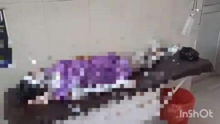 कैसरगंज: सिसई पुरवा गांव में खाना बनाते समय महिला गंभीर रूप से झुलसी, किया गया मेडिकल कॉलेज रेफर