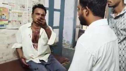 पिंडवाड़ा: भीमाना के पास करीब 6 लोगों ने बाइक सवार के साथ की मारपीट, बाइक में की तोड़फोड़