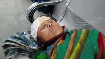 सुपौल: फुलवरिया गांव में जमीनी विवाद में दो पक्षों के बीच मारपीट, पति-पत्नी हुए घायल